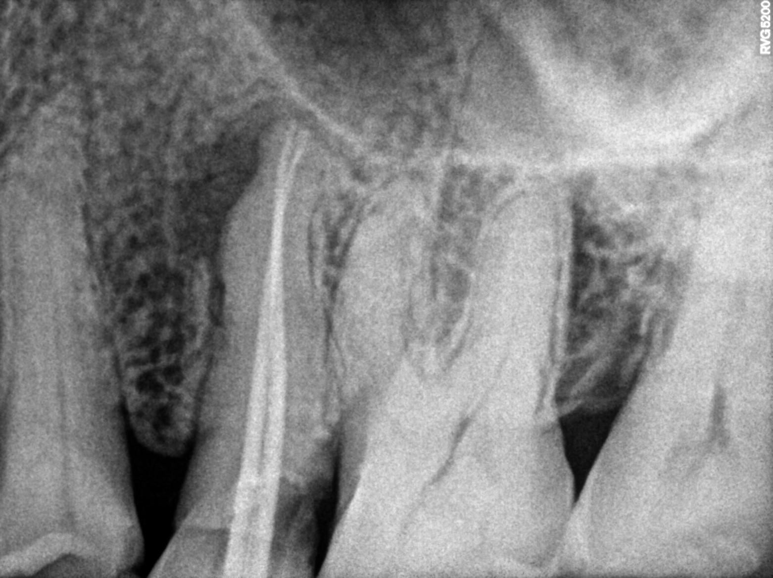 Dental X-ray